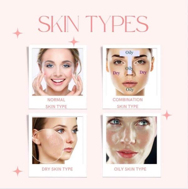 Skin Types 
