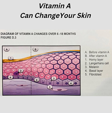 Vitamin A changes skin