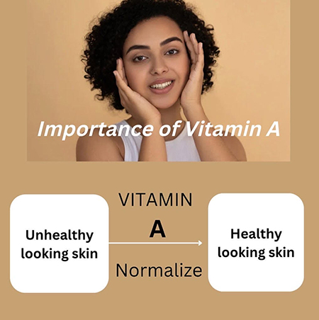 Vitamin A