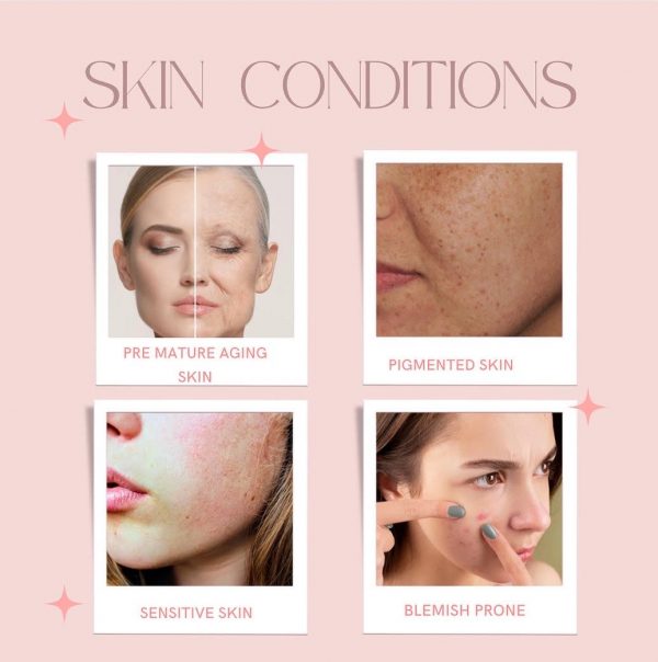 Skin Conditions