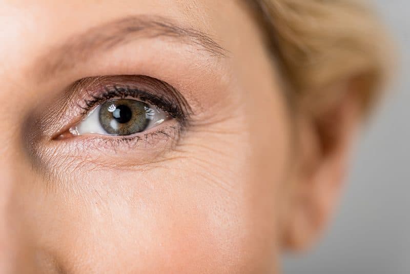 Eye Lift, Blepharoplasty