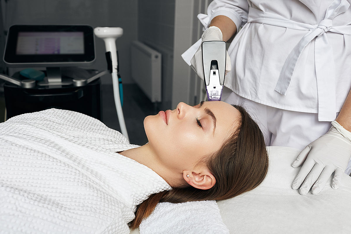 Microneedling