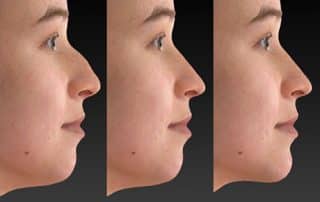 Facial computer imaging 3D