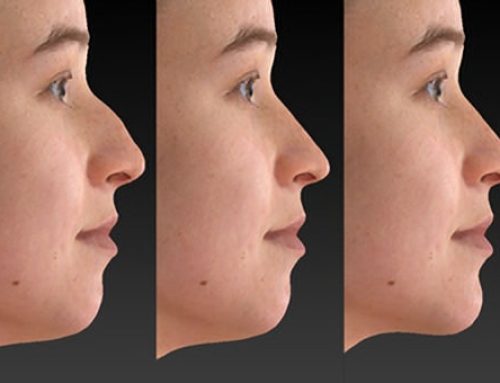 3D Facial Computer Imaging