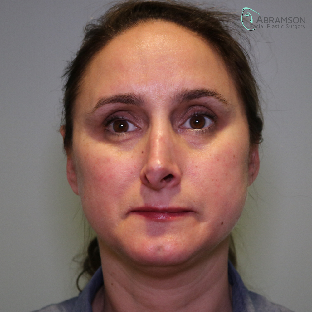 Revision before 1000with logo copy