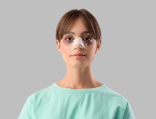 Rhinoplasty, What to Expect After Surgery
